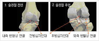  	1.슬관절 전면 : 내측 반원상 연골 / 전방십자인내 	2.슬관절 후면 : 후방십자인대 / 외측 반월상 연골  	