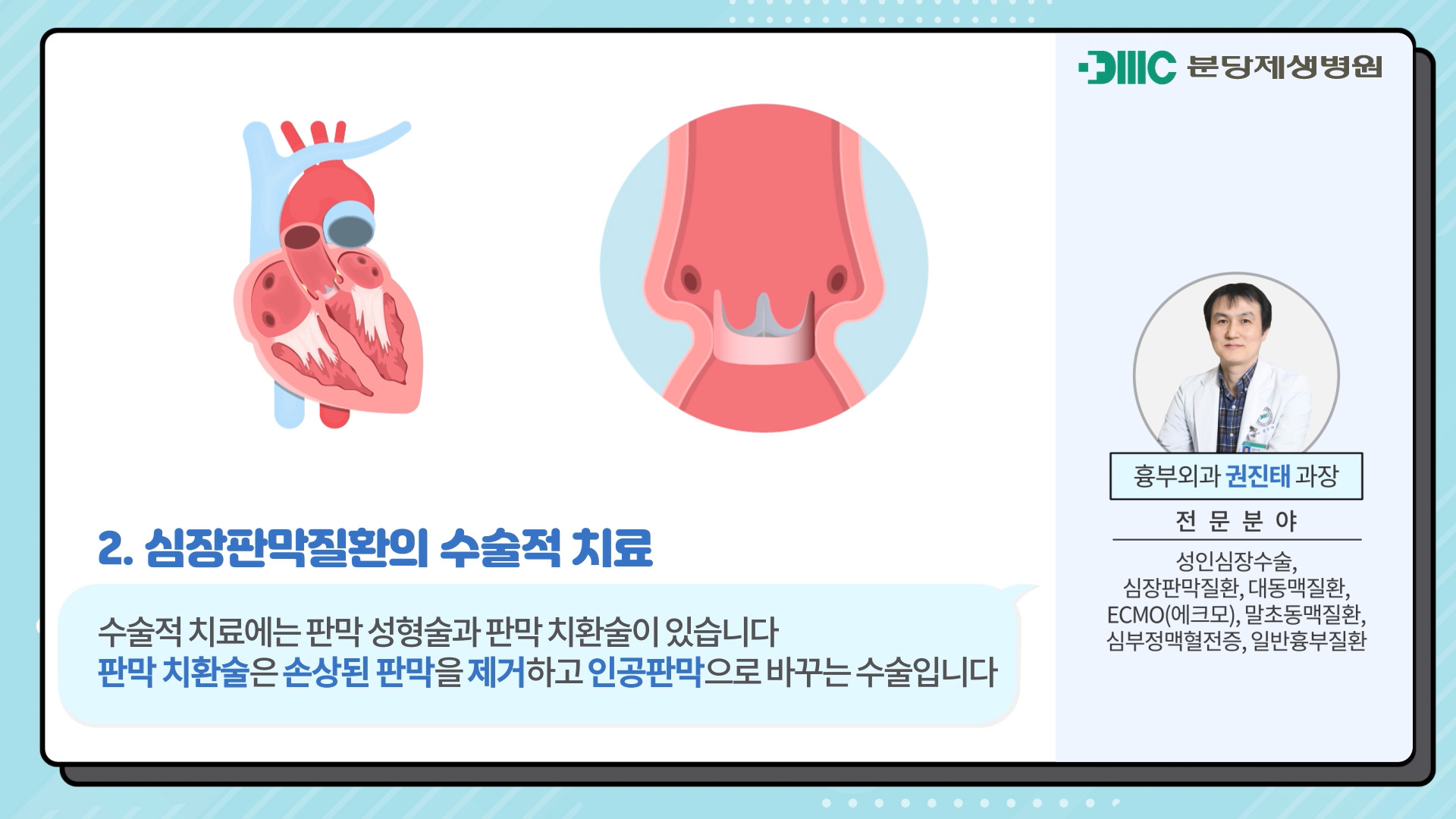 심장판막질환