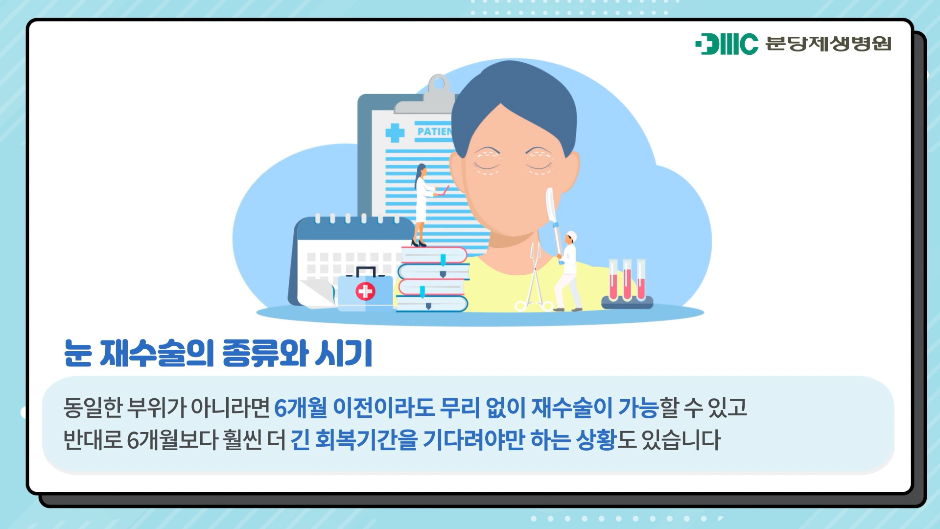 눈 재수술의 종류와 시기