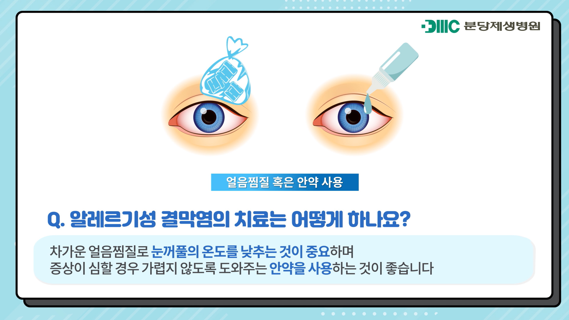 알레르기 결막염이란?