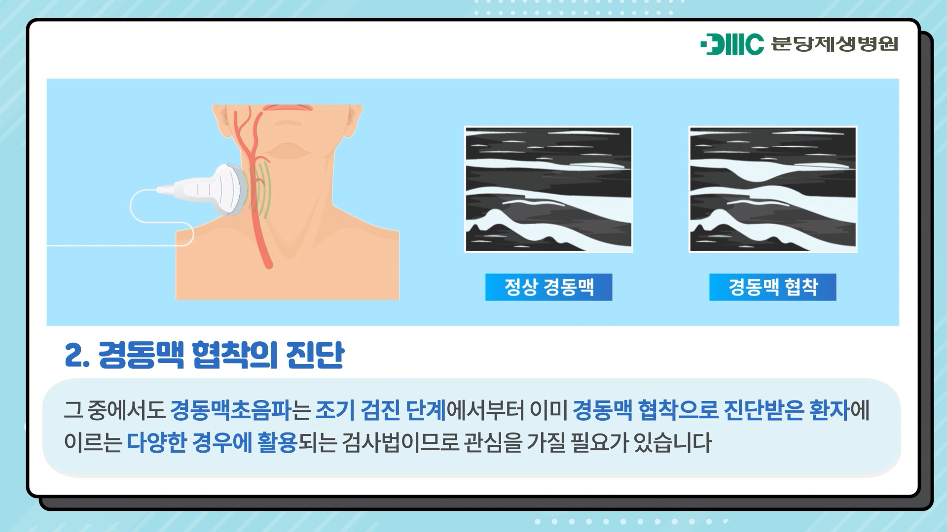 경동맥 협착이란?