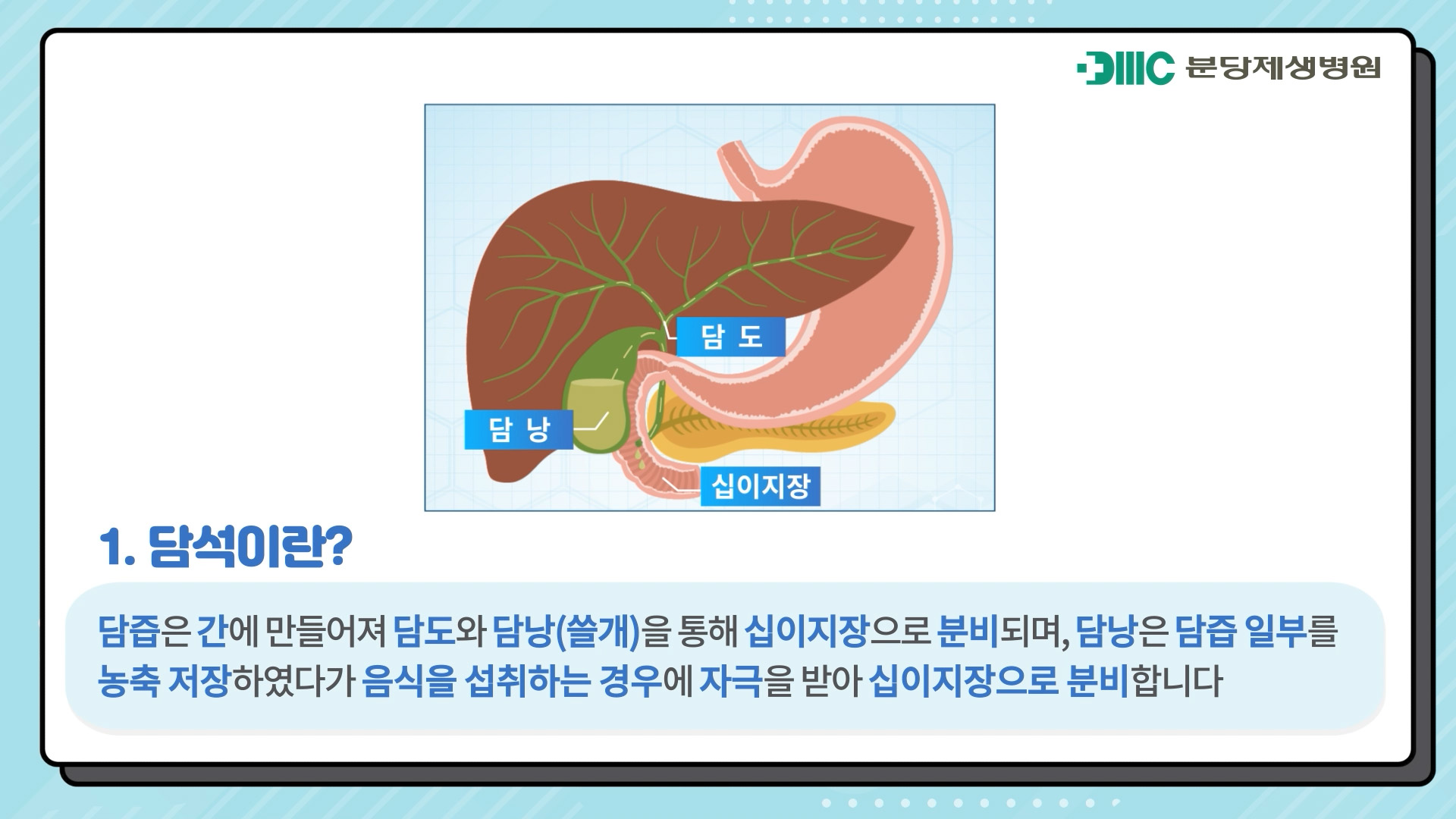 담석이란?