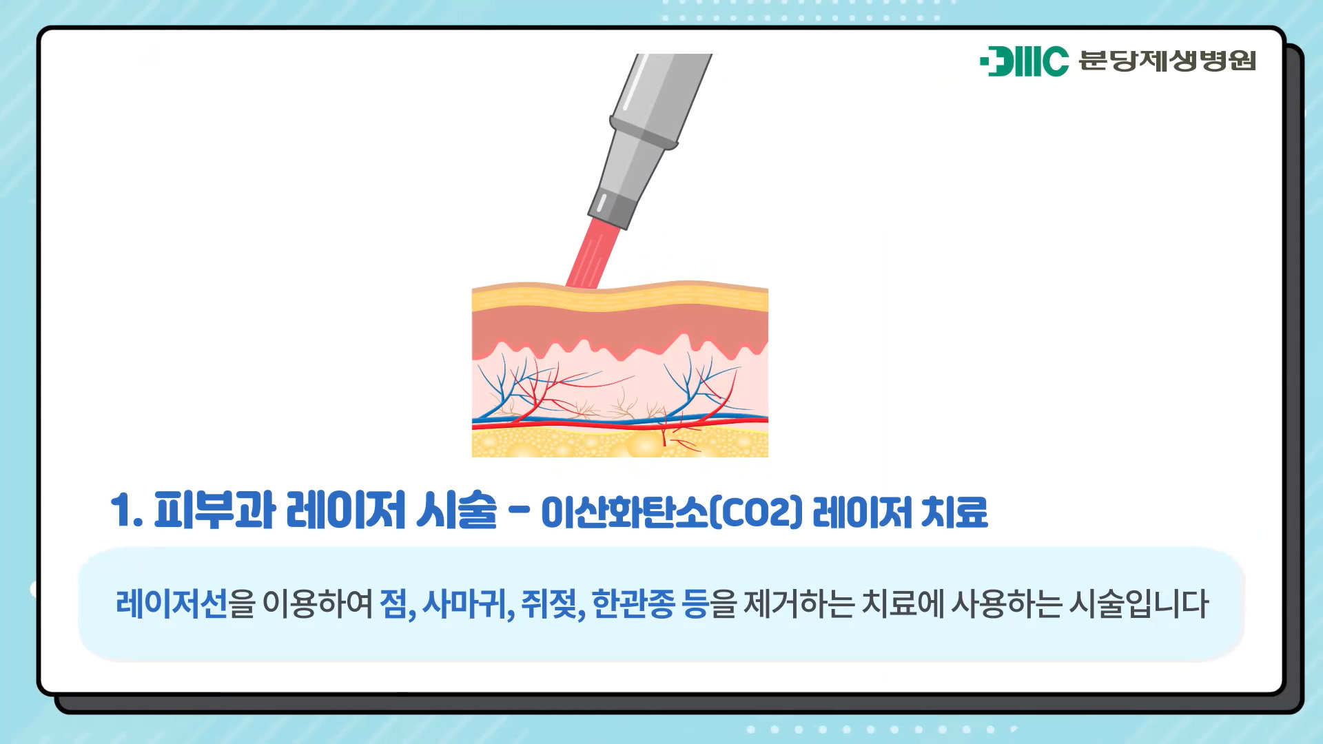 피부과 레이저 시술,피부과 냉동치료