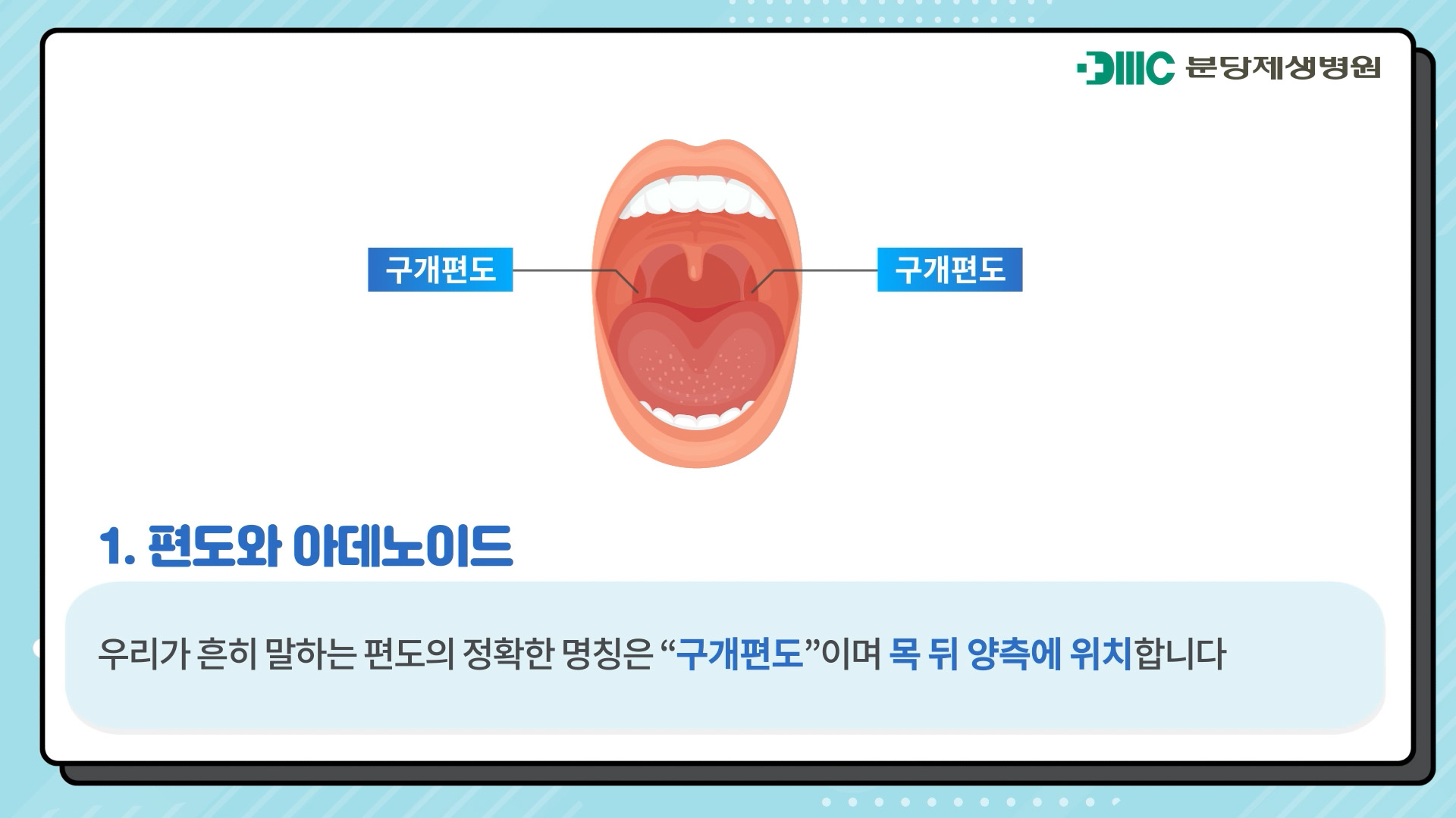 편도와 아데노이드의 수술