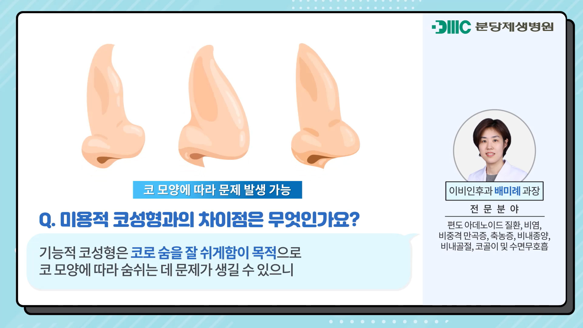 기능적 코성형이란