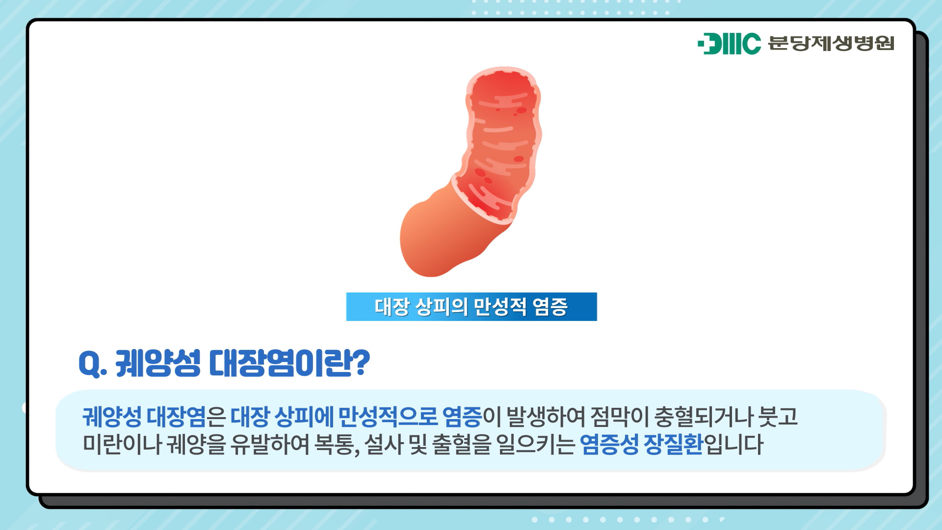 궤양성 대장염이란?