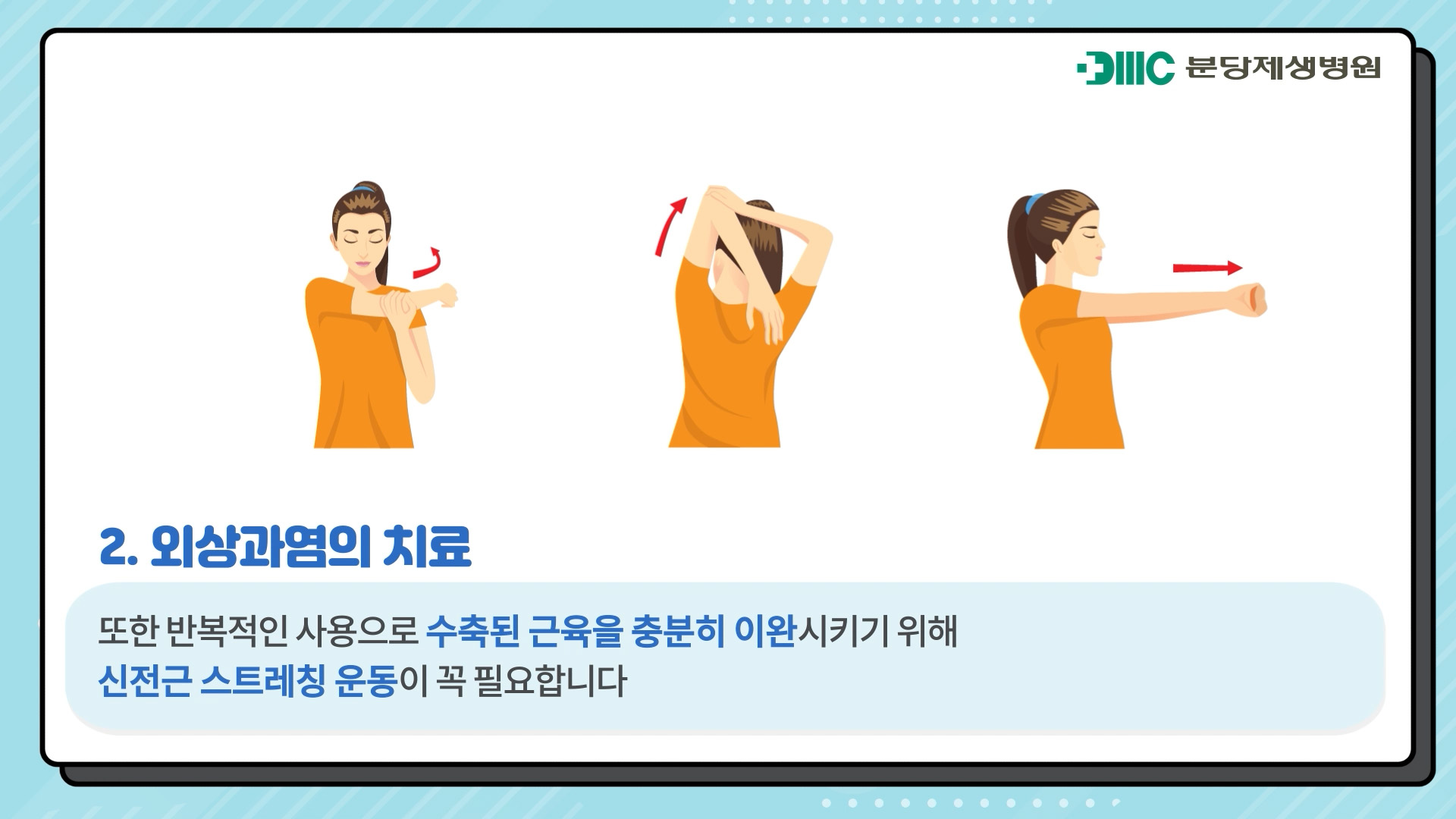 팔꿈치 외상과염 (Tennis Elbow)