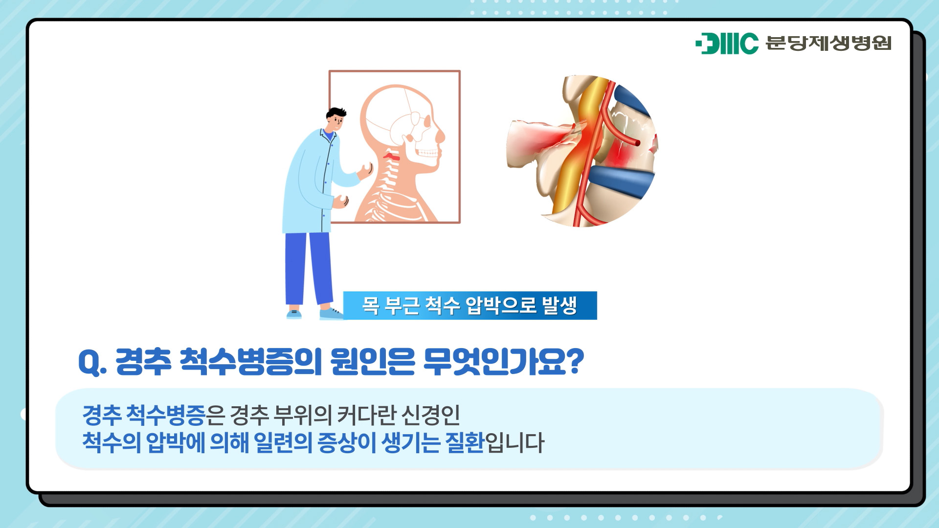 경추척수병증