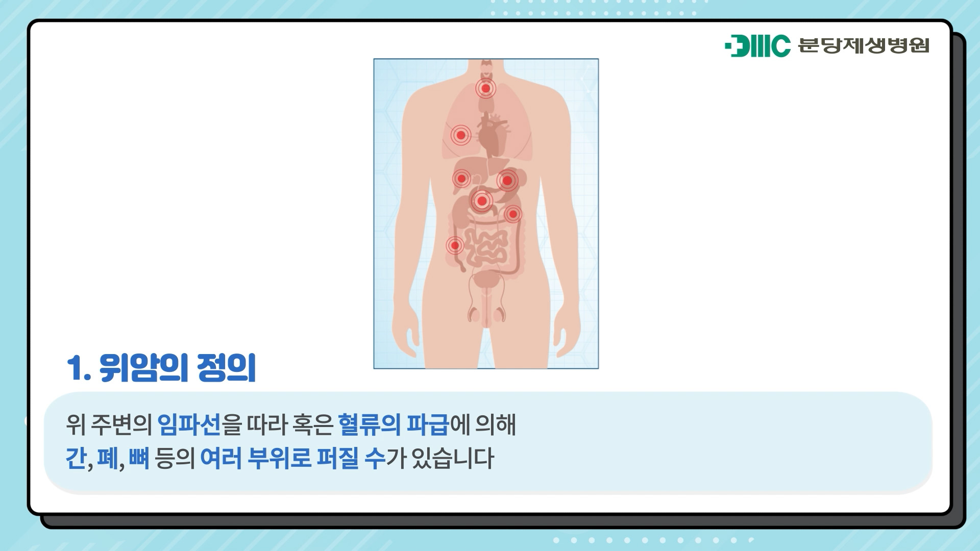 위암의 원인과 치료