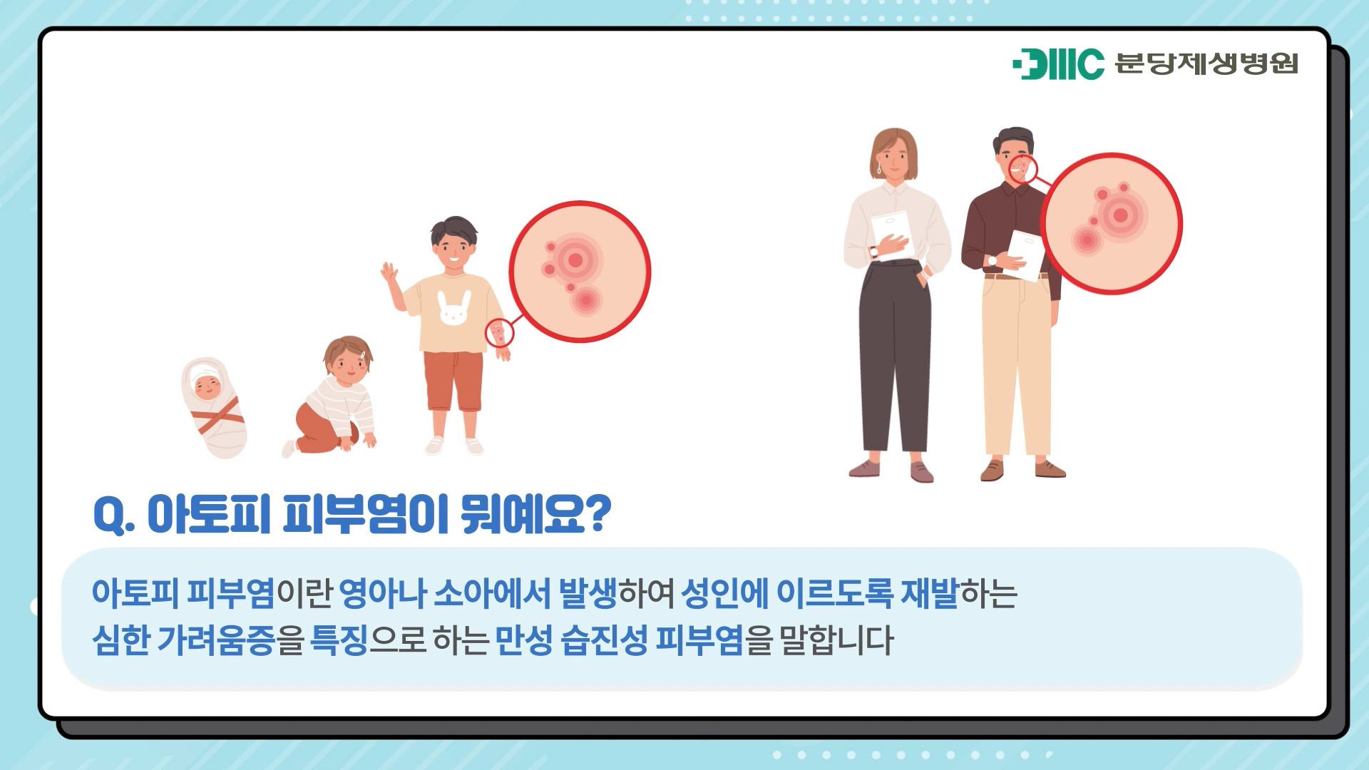 아토피 피부염의 치료와 예방