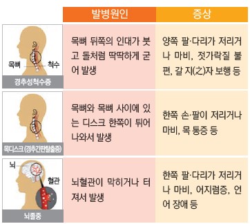 경추성척수증: 발병원인-목뼈 뒤쪽의 인대가 붓고 돌처럼 딱딱하게 굳어 발생, 증상-양쪽 팔다리 저리거나 마비, 젓가락질 붙편, 갈지자 보행 등. 목디스크(경추간판탈출증): 발병원인-목뼈와 목뼈사이에 있는 디스크 한쪽이 튀어나와서 발생, 증상: 한쪽 손팔이 저리거나 마비, 목 통증등. 뇌졸증: 발병원인-뇌혈관이 막히거나 터져서 발생, 증상-한쪽 팔다리가 저리거나 마비, 어지럼증, 언어 장애 등