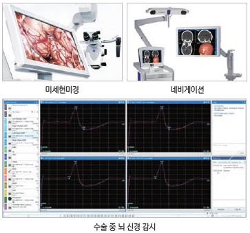 상단 좌측은 미세현미경 / 상단 우측은 네비게이션 / 하단은 수술중 뇌신경 감시 사진 입니다.