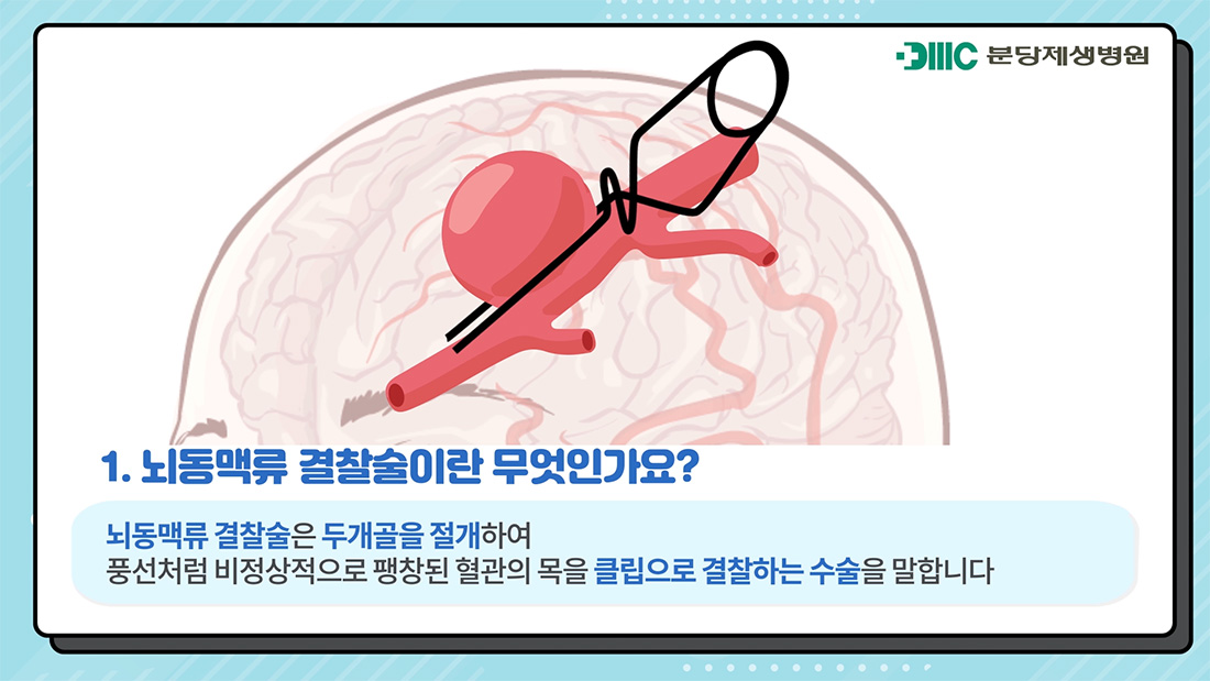 1.뇌동맥류 결찰술이란 무엇인가요? 뇌동맥류 결찰술은 두개골을 절개하여 풍선처럼 비정상적으로 팽창된 혈관의 목을 클립으로 결찰하는 수술을 말합니다.